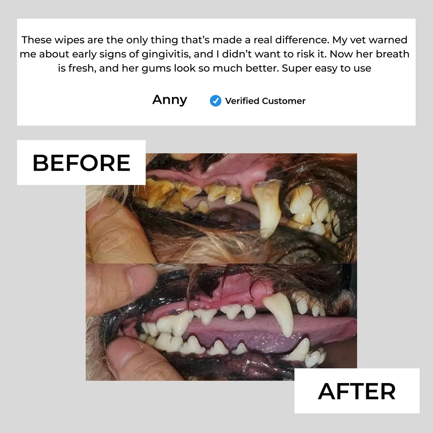 Glorovi Dental Finger Wipes