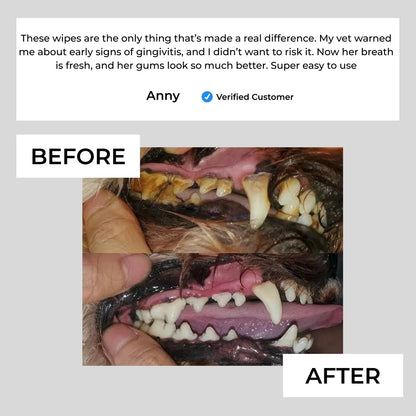 Glorovi Dental Finger Wipes
